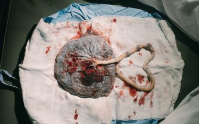 Photo Birth control pill