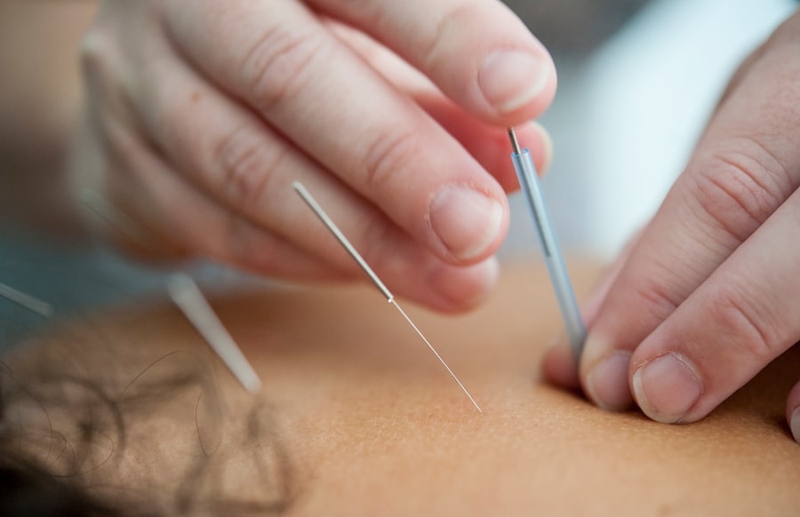 A Contramal 200 egy fájdalomcsillapító gyógyszer, amely a tramadol hatóanyagot tartalmazza. A tramadol egy középkategóriás opioid analgetikum, amelyet különböző típusú fájdalmak kezelésére használnak, beleértve a mérsékelt és súlyos fájdalmakat is. A gyógyszer hatásmechanizmusa összetett: a központi idegrendszerre gyakorolt hatásán keresztül csökkenti a fájdalomérzetet, miközben befolyásolja a szervezet endogén fájdalomcsillapító rendszereit is.