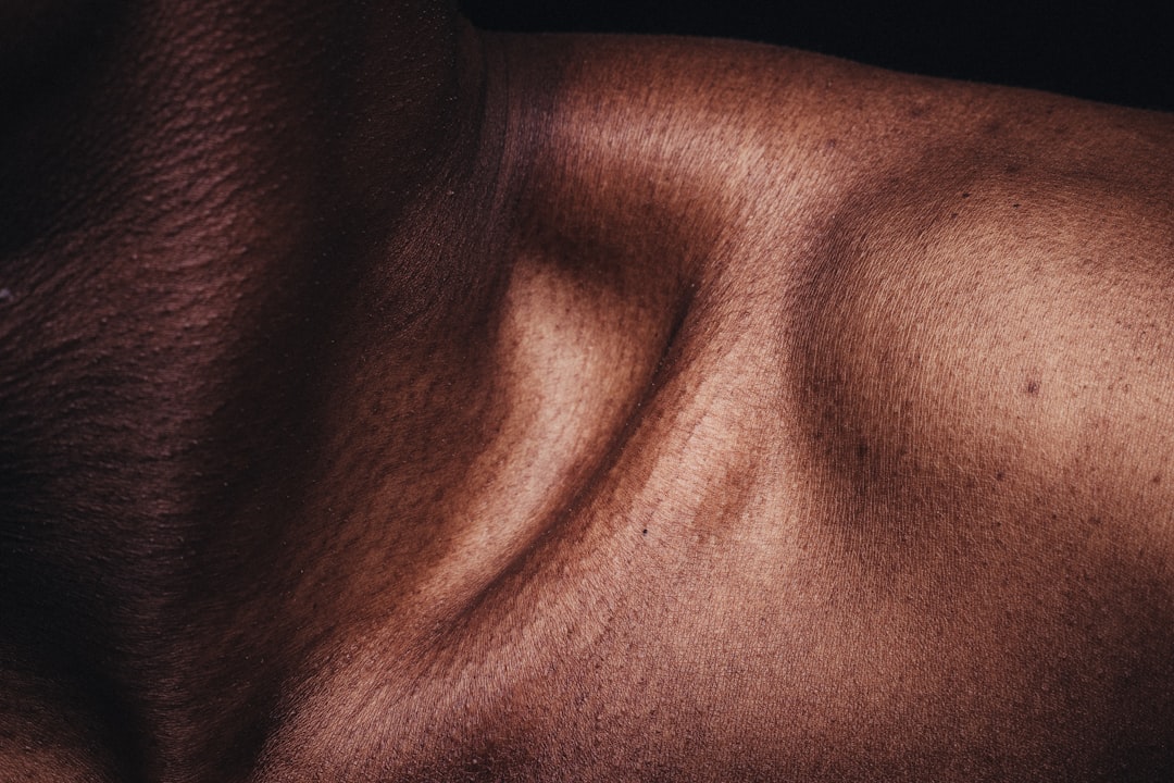 Photo itchy skin