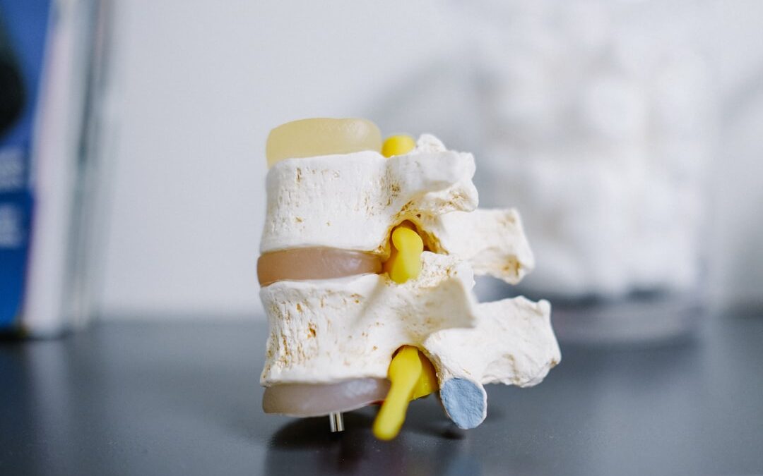 Photo Bone density scan