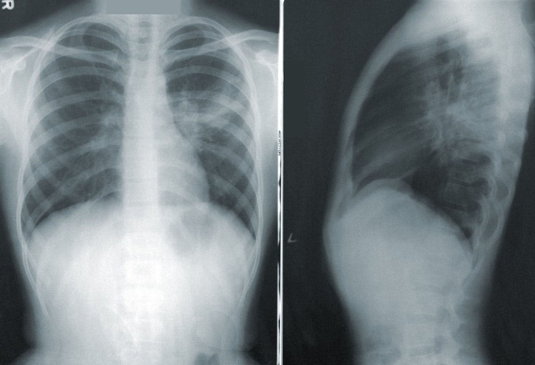 Photo CT scan
