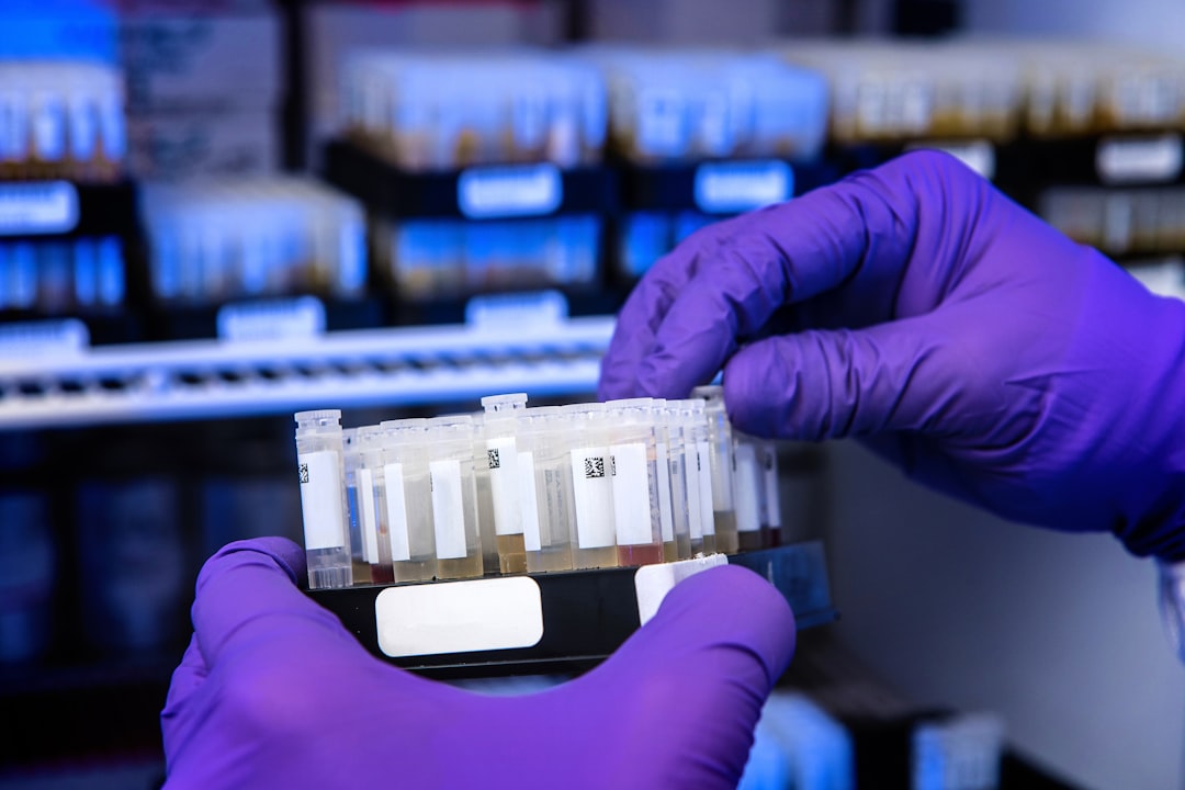 Photo Blood test