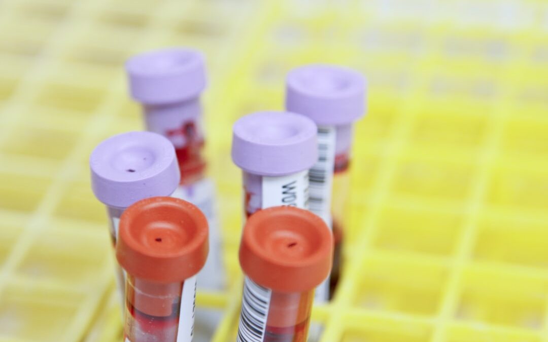 Photo Blood test