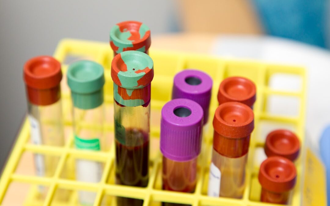 Photo Blood test