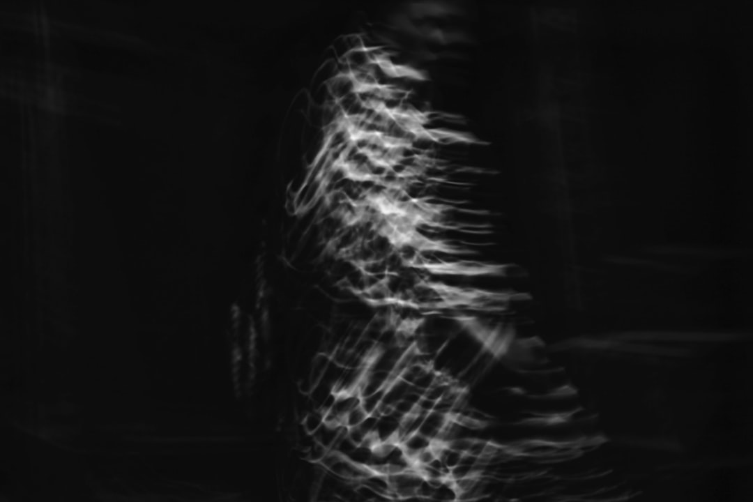 Photo MRI scan