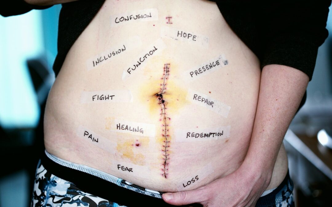 Photo Skin cancer