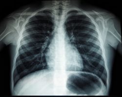 Photo CT scan