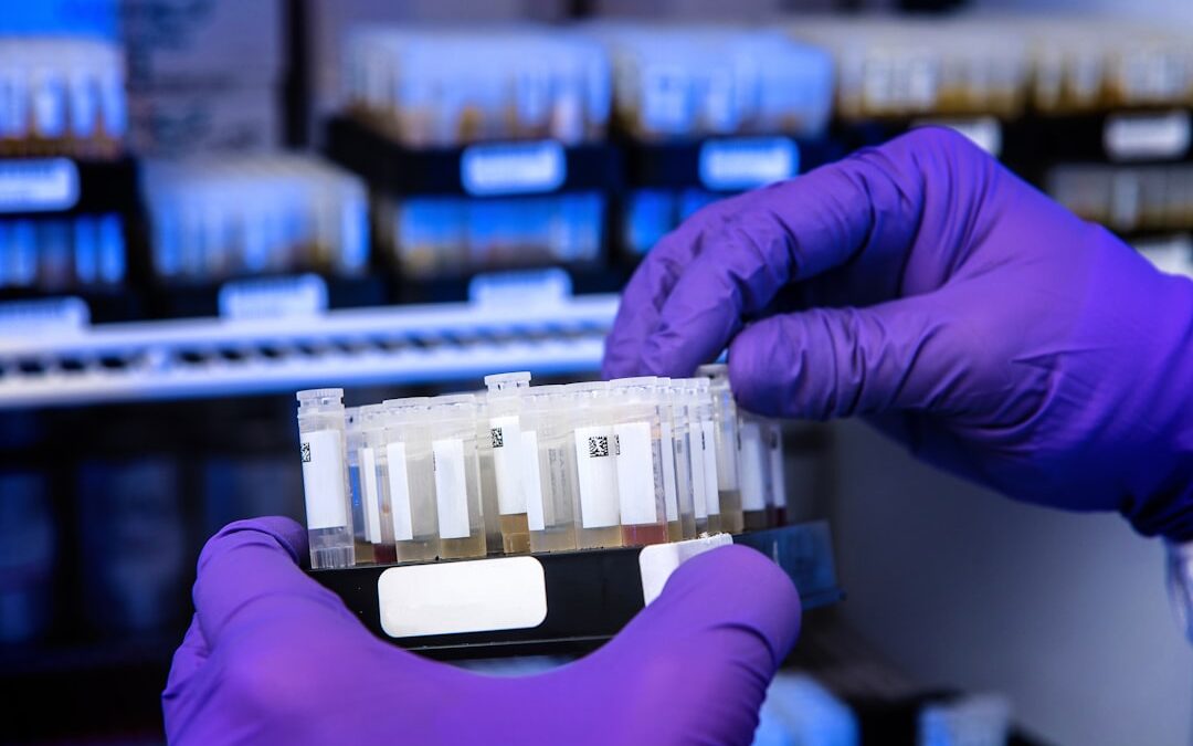 Photo Blood test