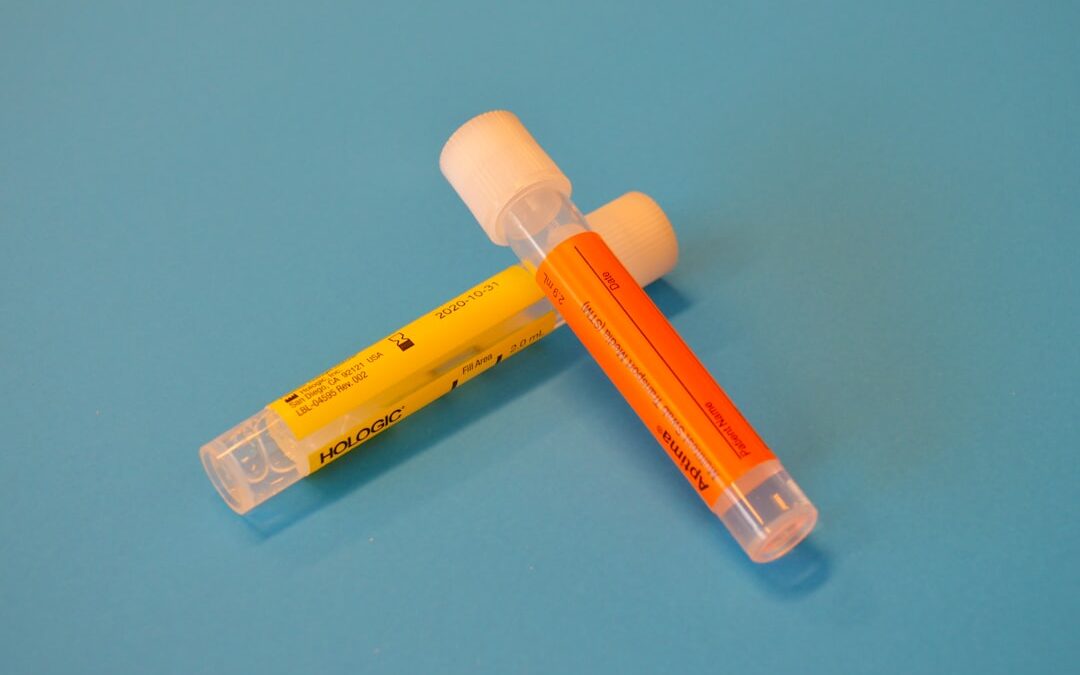 Photo Blood test
