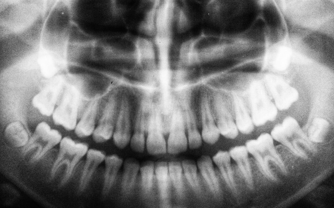 A tüdőrák diagnosztizálása: fontos lépések és vizsgálatok