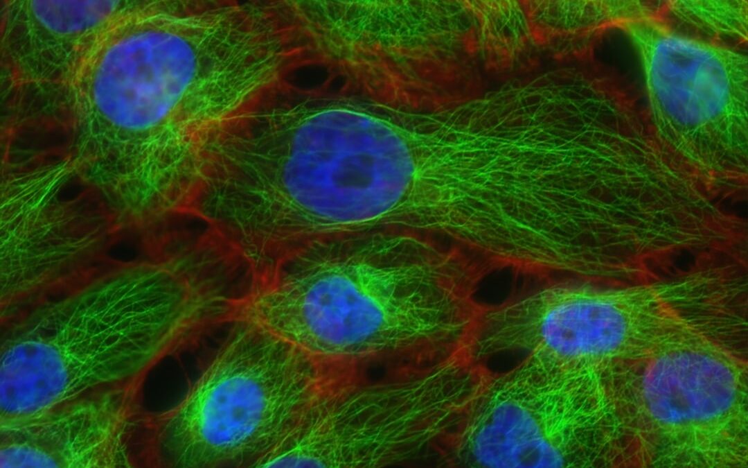 A colitis ulcerosa okai: tünetek és kezelés