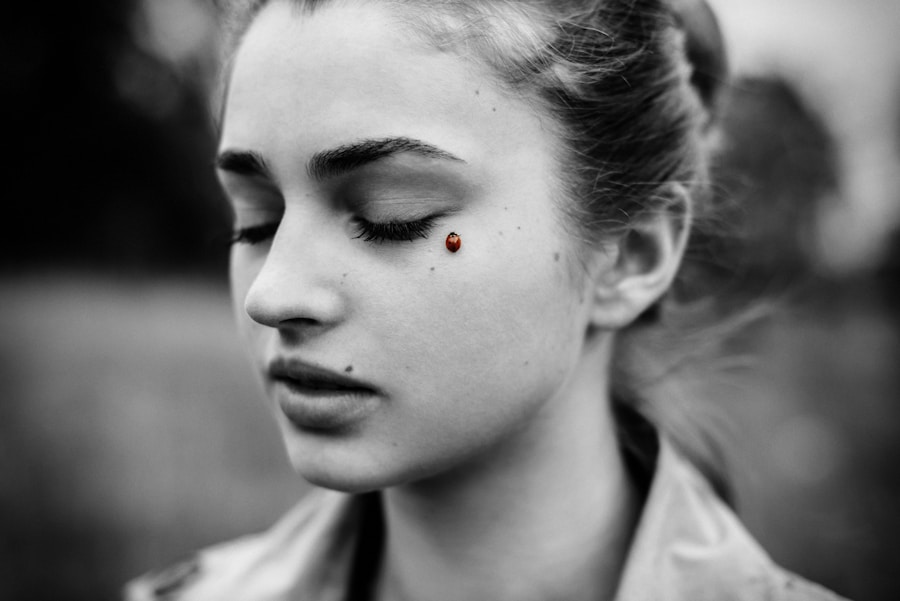 Photo "large inflamed pimple"