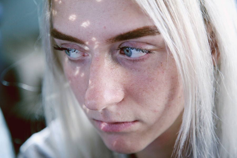 Photo a vitamin against acne