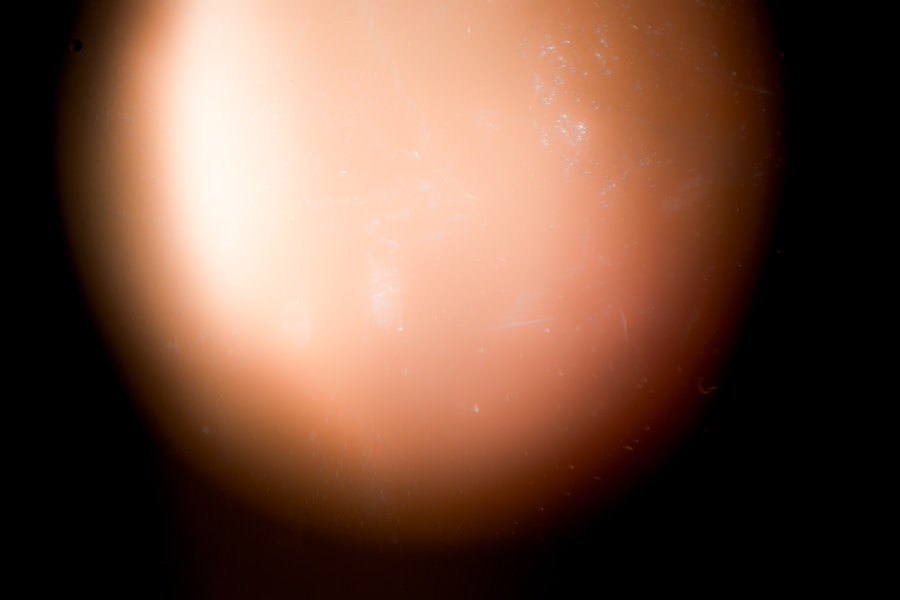 Photo acne pimple