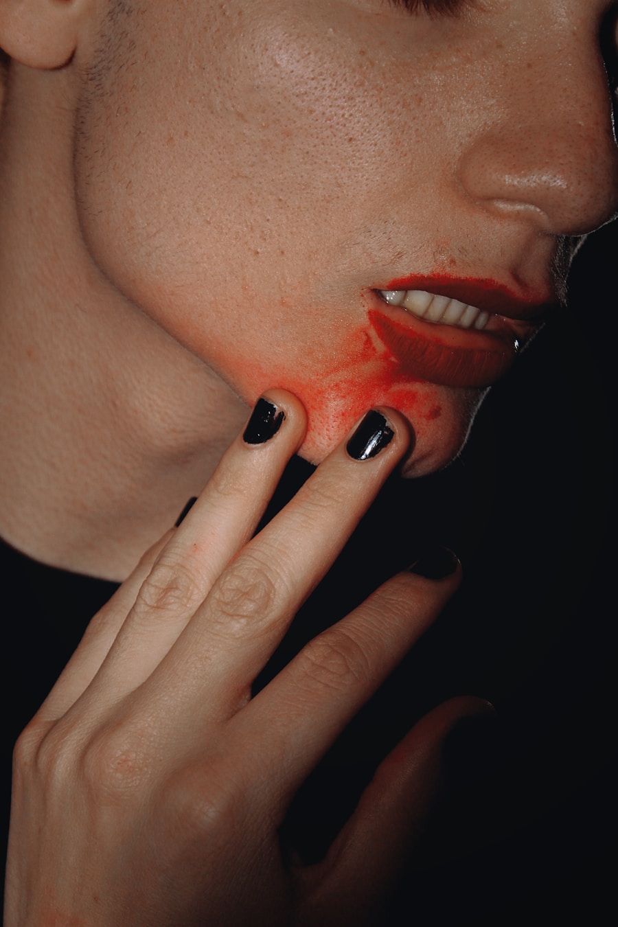 Photo against acne