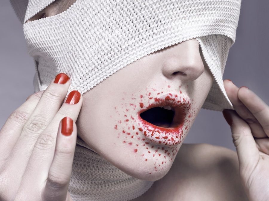 Photo "removal of acne scars"