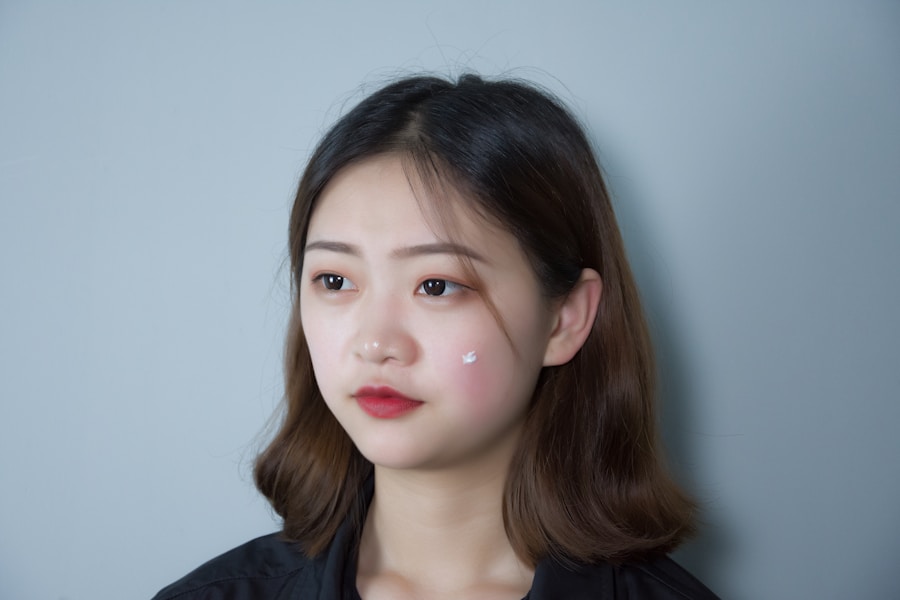 Photo Acne-prone skin