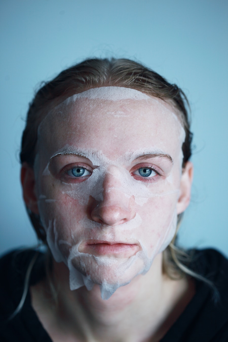 Photo "treatment of hormonal acne"