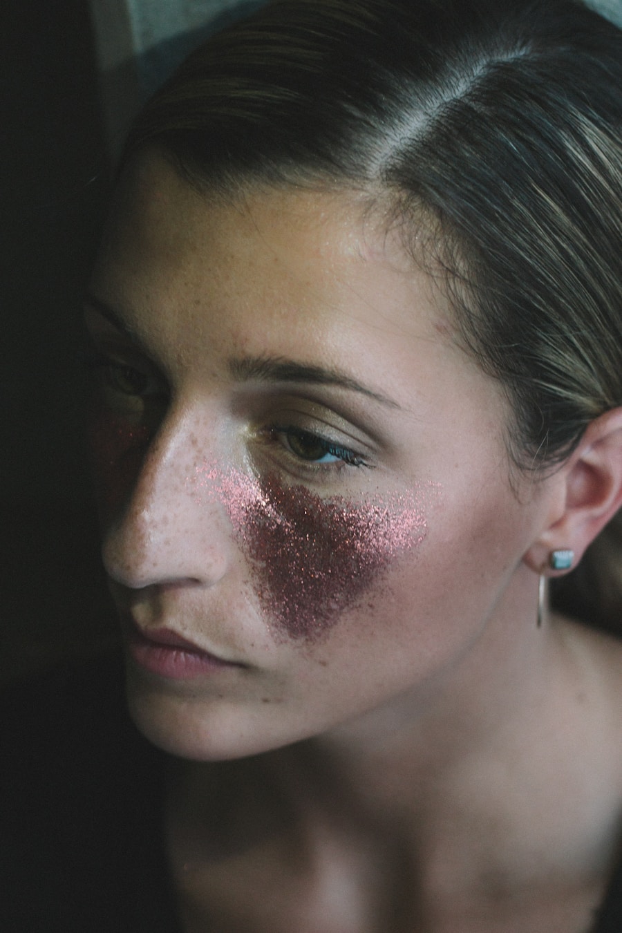 Photo Inflammatory acne