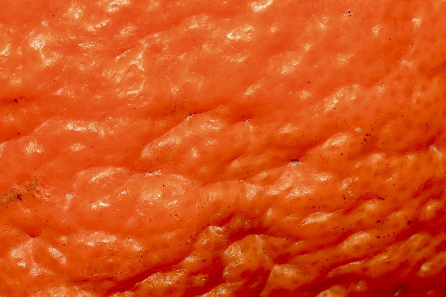 Photo Inflammatory acne