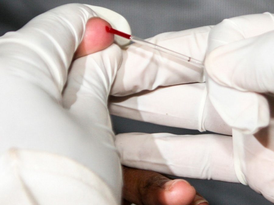 Photo aids blood test