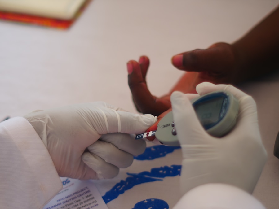 Photo incubation period of AIDS