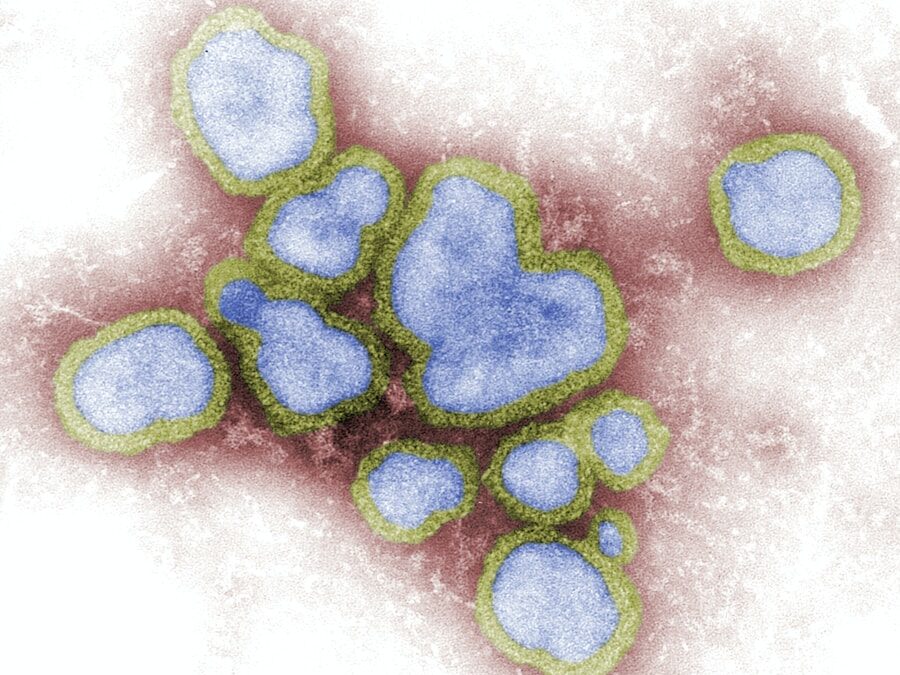 Photo "Acquired immunodeficiency disease"