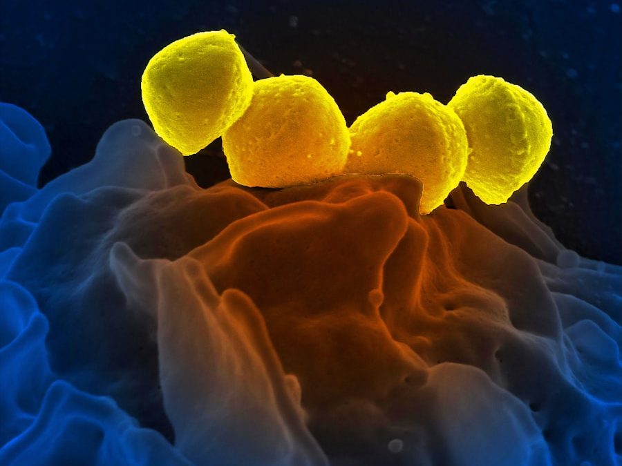 Photo "first symptoms of HIV virus"