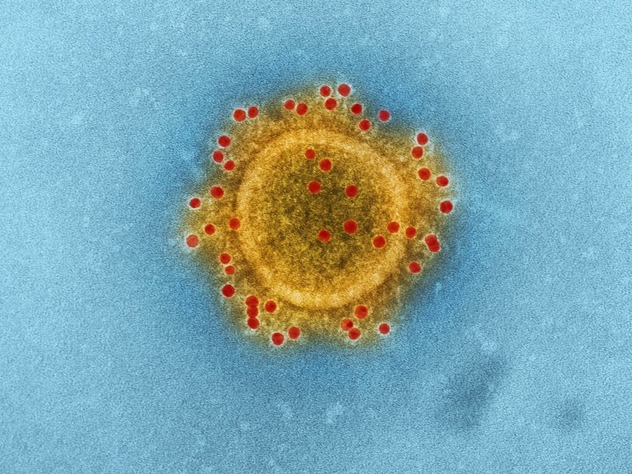 Photo aids virus