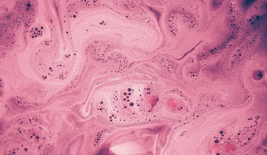 Photo Spongiform encephalitis