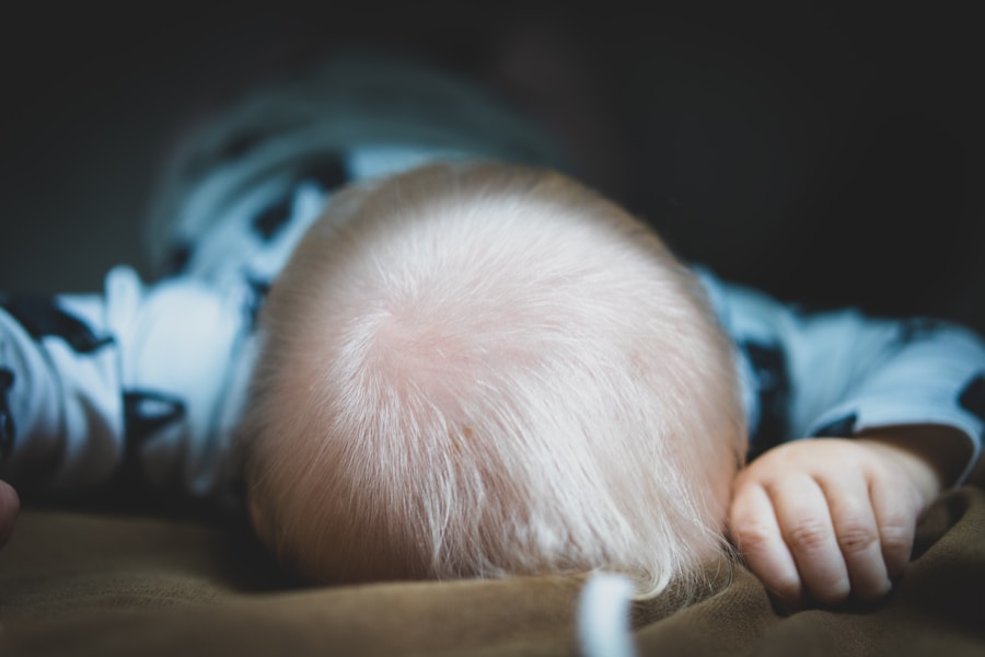 Photo Infant concussion