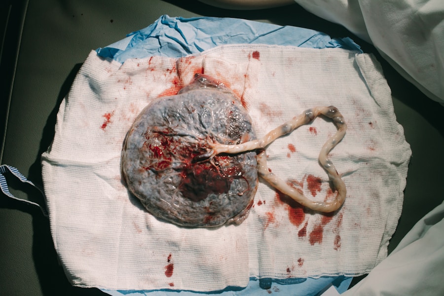Photo "Diagnosis of brain tumor"