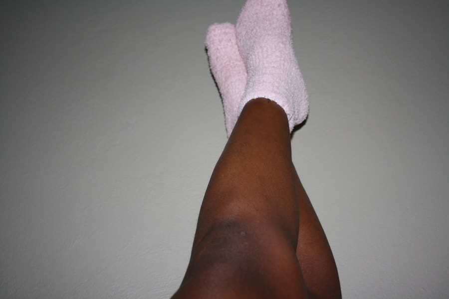 Photo Afta treatment at home