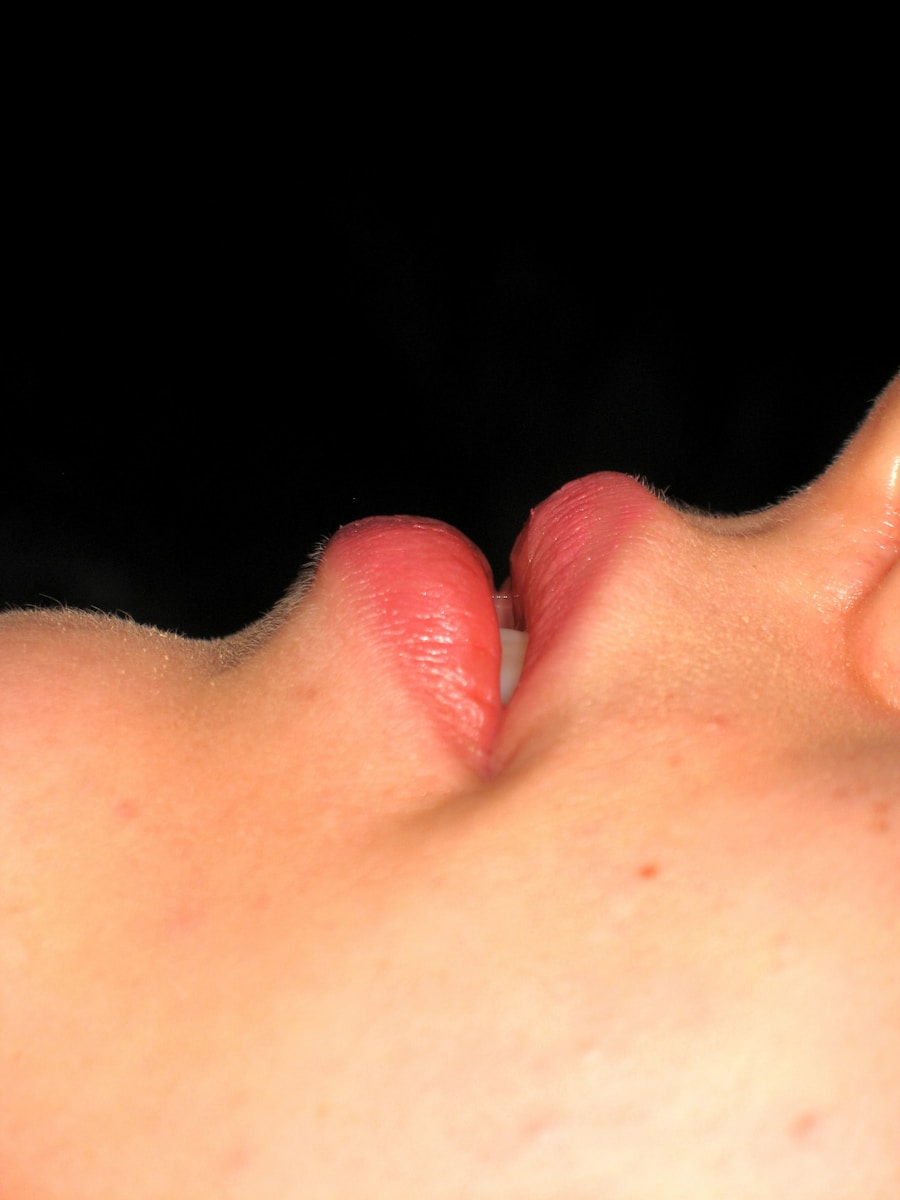 Photo Treatment of canker sores