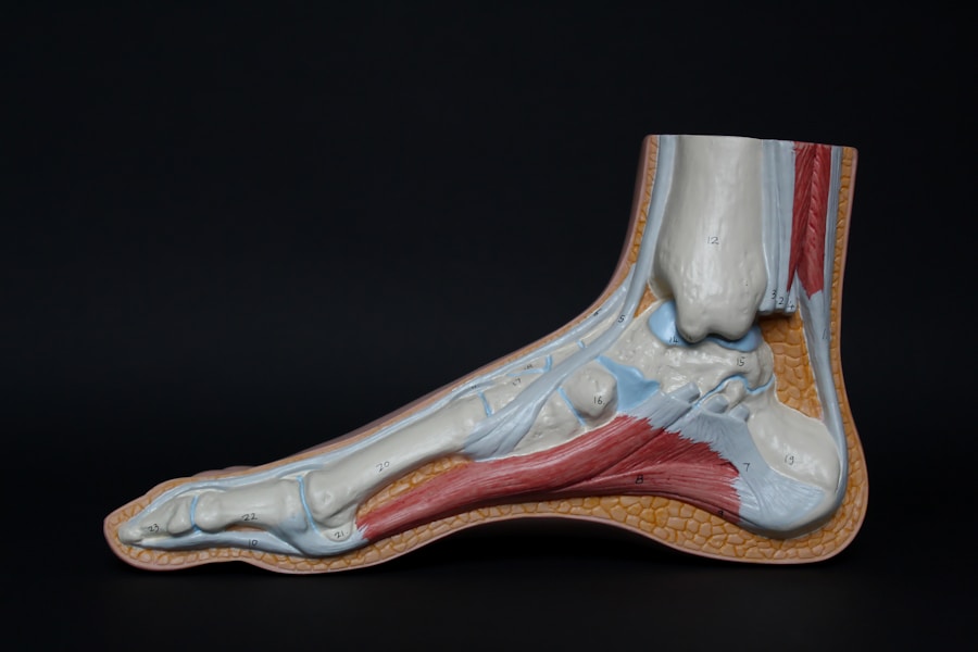 Photo "treatment of Achilles tendon inflammation"