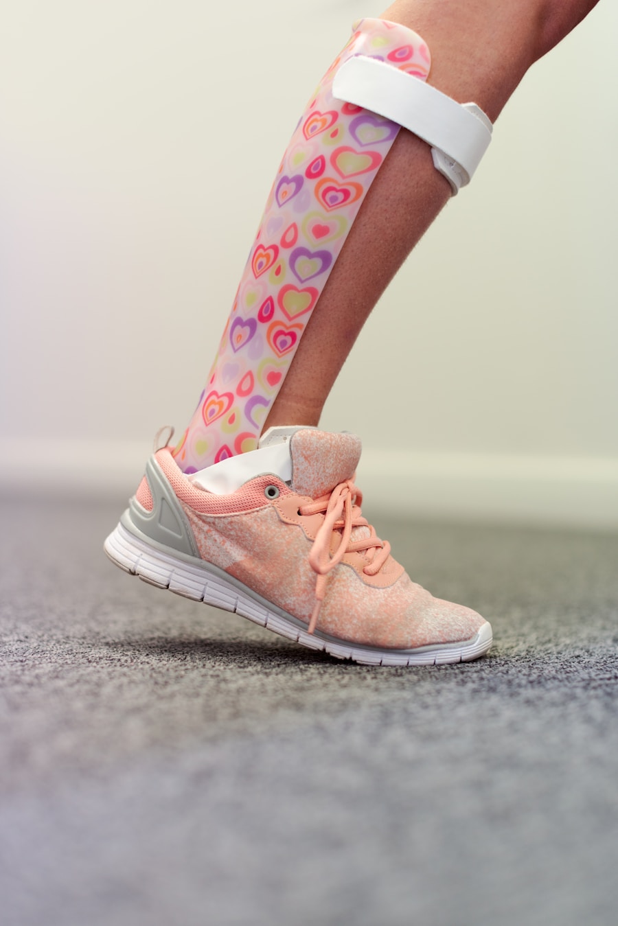 Photo Achilles tendon inflammation cast