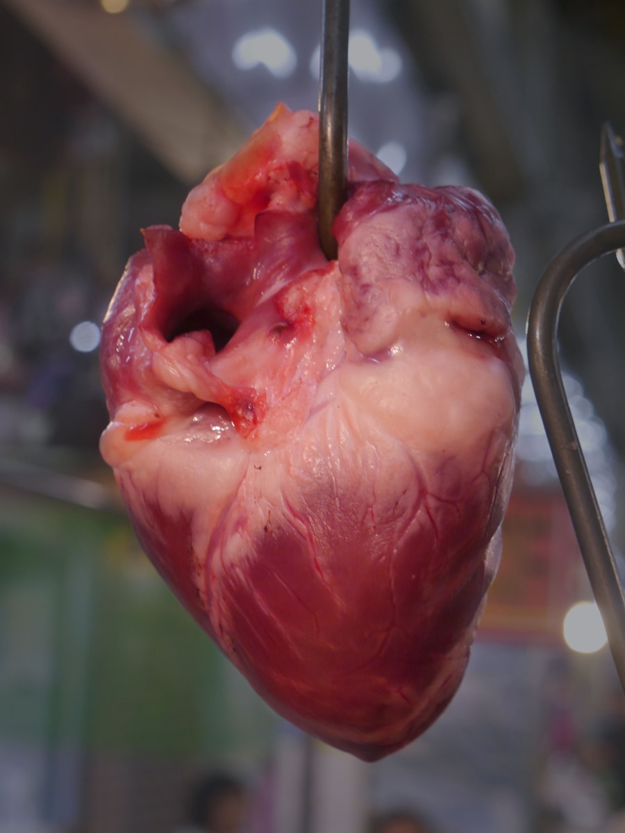 Photo "Symptoms of acute heart failure"