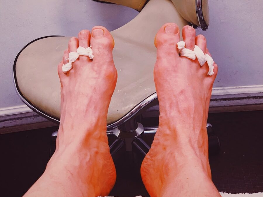 Photo "Treatment of gout"