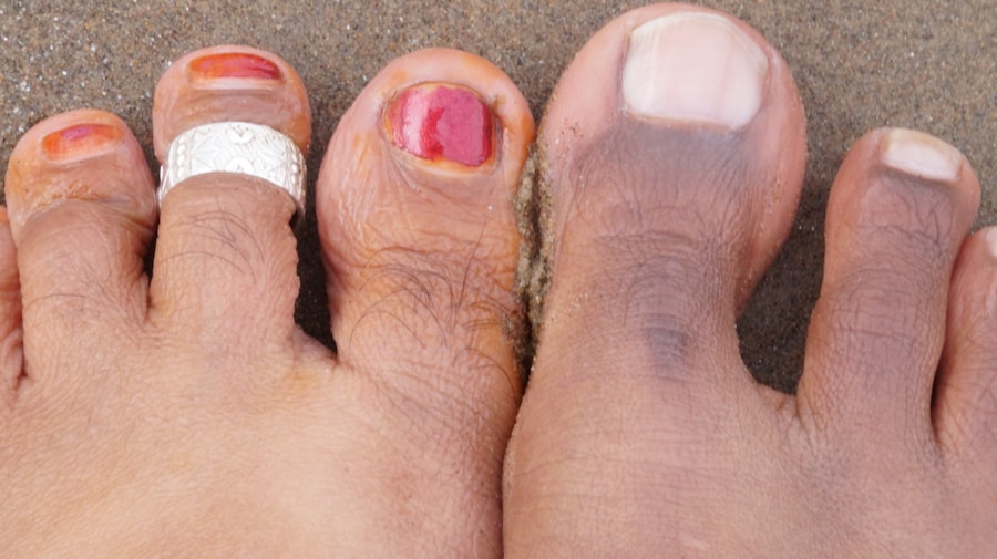 Photo "Prevention of gout"