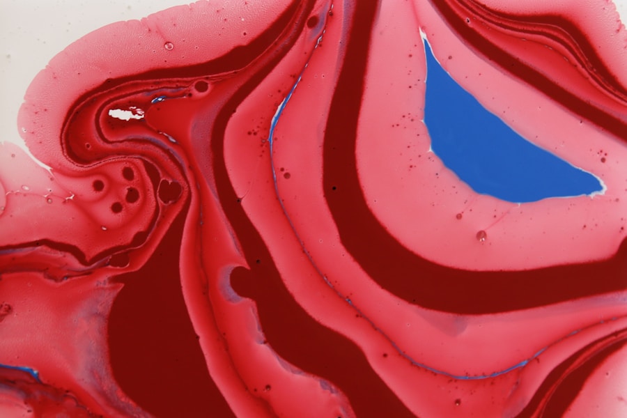 Photo "Types of amyloidosis"
