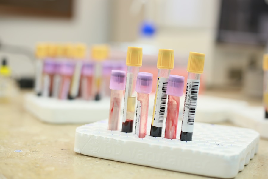 Photo Vitamin B12 blood test