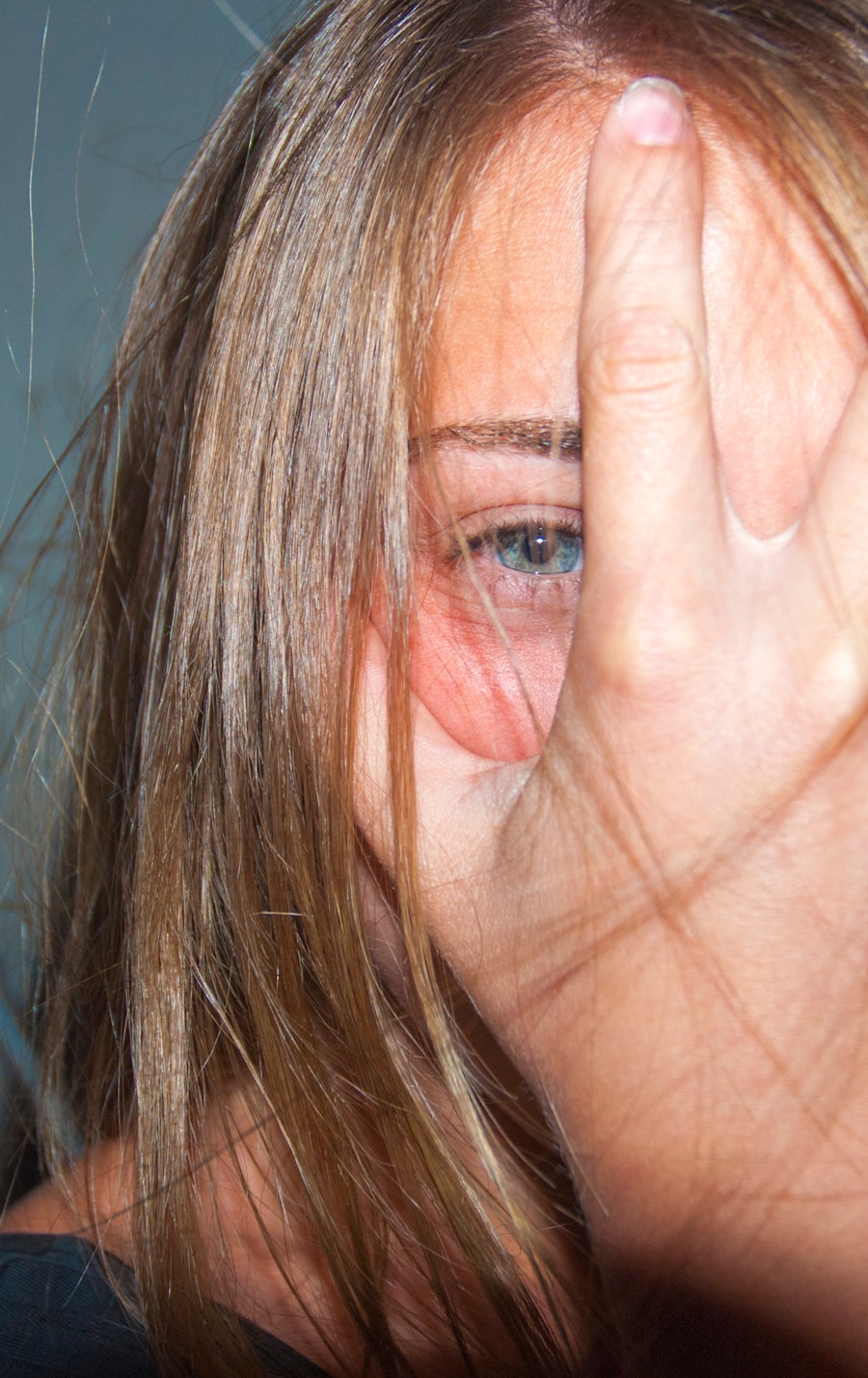 Photo Symptoms of Vitamin B12 deficiency