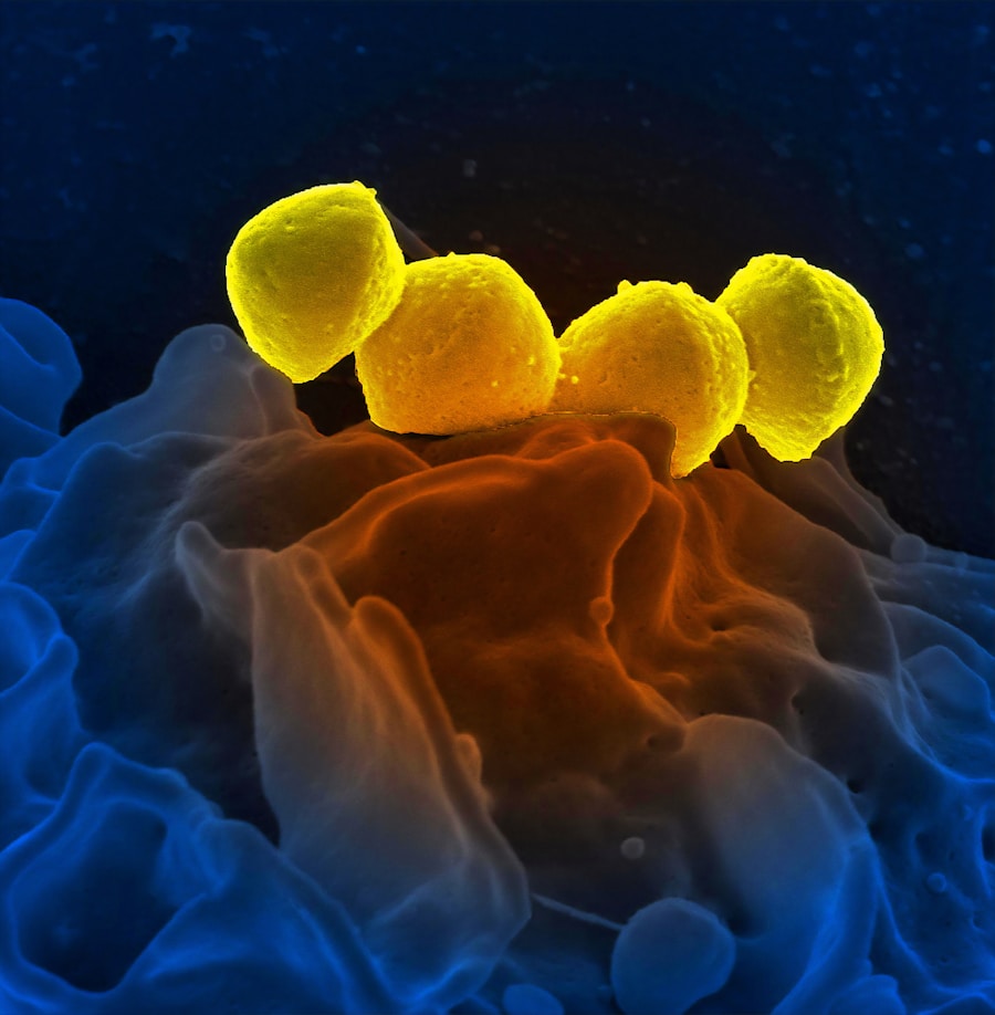 Photo "Diagnosis of autoimmune hepatitis"