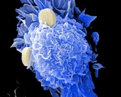 Photo Immunology
