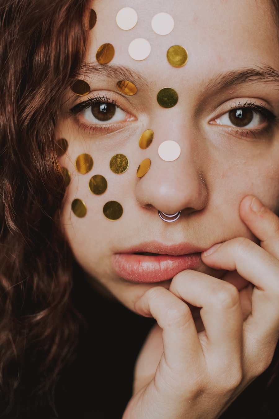 Photo "Chickenpox in adults"