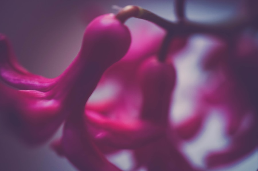 Photo Symptoms of aneurysm rupture