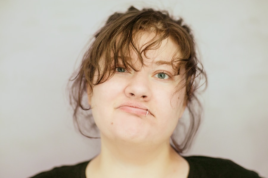 Photo Bells palsy research