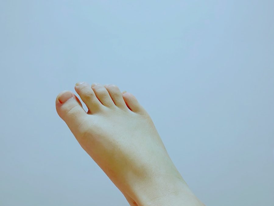 Photo "Home treatment for ingrown toenail"