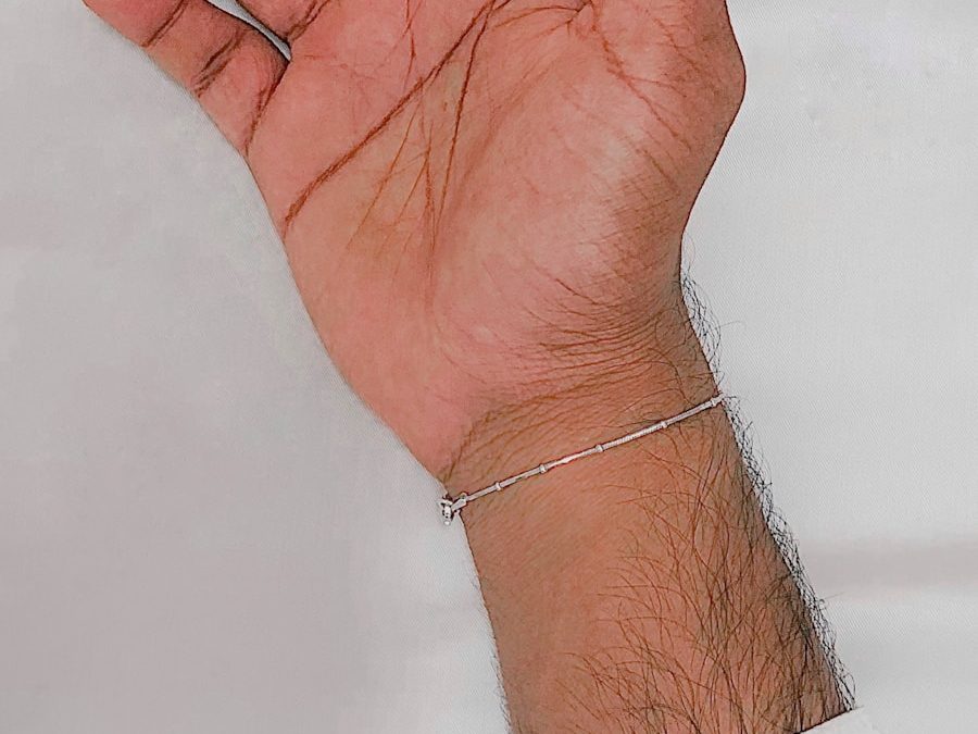 Photo Treatment of intercostal neuralgia