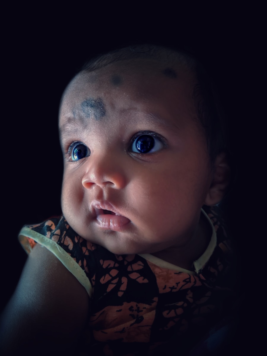 Photo Birthmarks